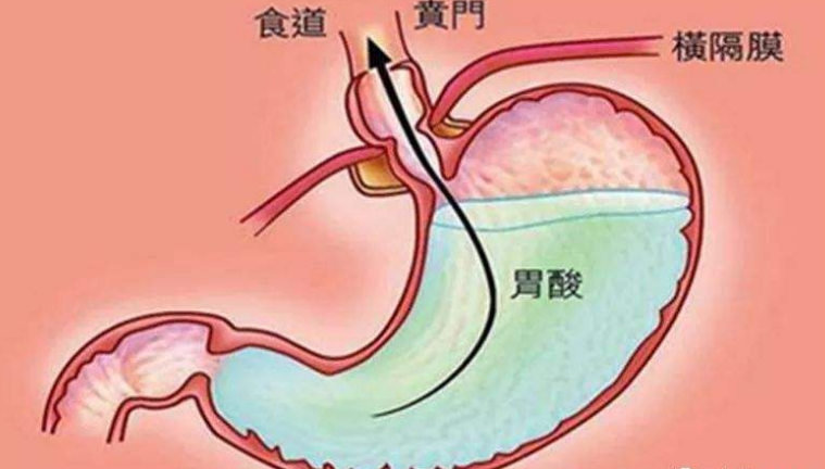 医学中BAO是什么意思