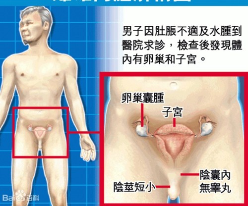 双性人是什么样的一种人?