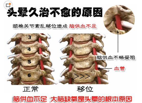 钩活术的治疗地位