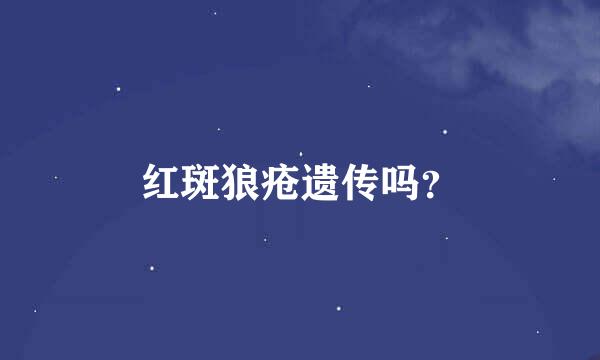 红斑狼疮遗传吗？