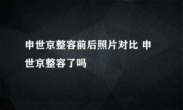 申世京整容前后照片对比 申世京整容了吗