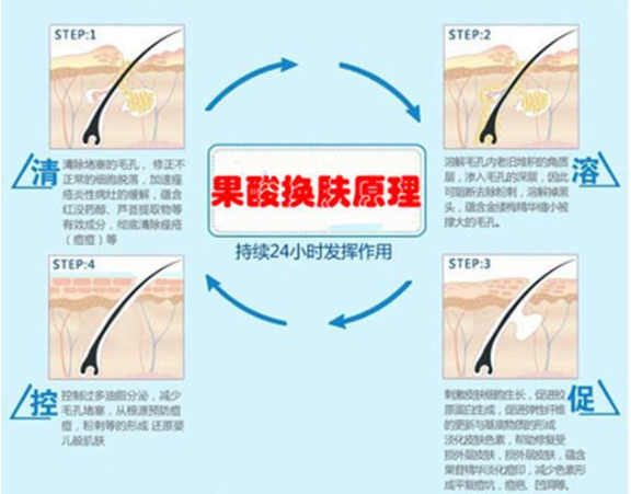 脸上有很深的痘坑怎么修复？