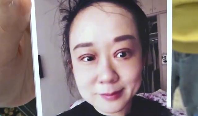 南昌一女子割双眼皮失败老公闹离婚，起诉医院后，法院是如何判决的？