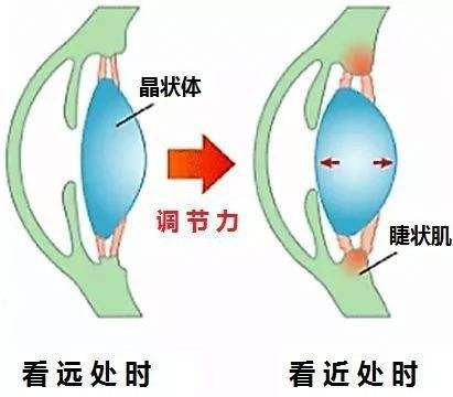 怎么让眼睛视力恢复