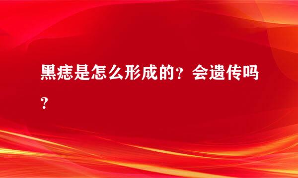 黑痣是怎么形成的？会遗传吗？