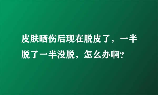 皮肤晒伤后现在脱皮了，一半脱了一半没脱，怎么办啊？