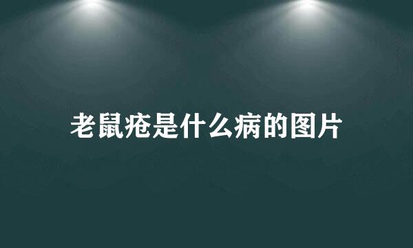 老鼠疮是什么病的图片