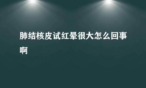 肺结核皮试红晕很大怎么回事啊