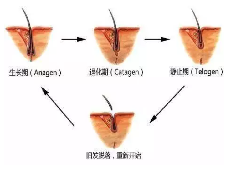 化疗后掉头发怎么办，能延缓吗？