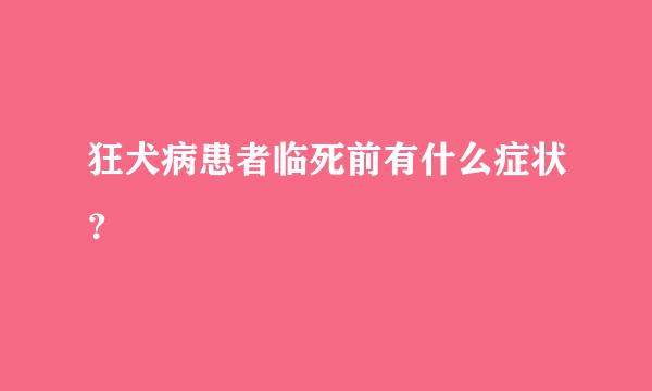 狂犬病患者临死前有什么症状？