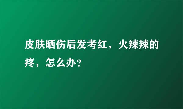 皮肤晒伤后发考红，火辣辣的疼，怎么办？