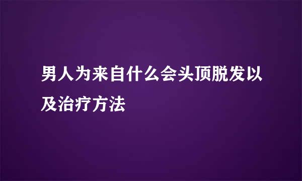 男人为来自什么会头顶脱发以及治疗方法