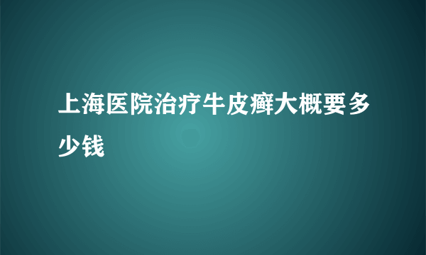 上海医院治疗牛皮癣大概要多少钱