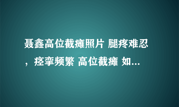 聂鑫高位截瘫照片 腿疼难忍，痉挛频繁 高位截瘫 如何解除高位截瘫后腿痛和痉挛？