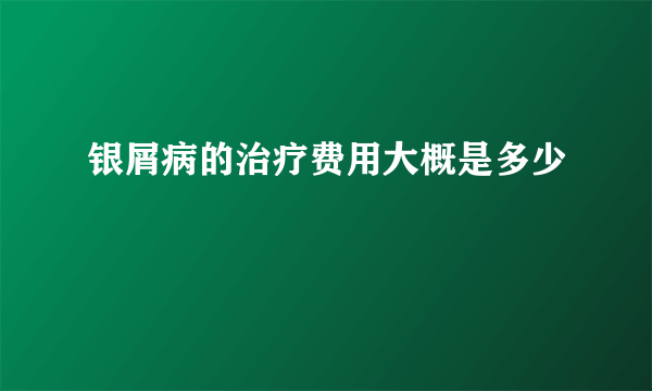 银屑病的治疗费用大概是多少