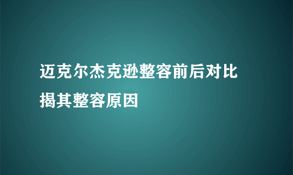 迈克尔杰克逊整容前后对比 揭其整容原因