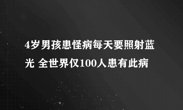 4岁男孩患怪病每天要照射蓝光 全世界仅100人患有此病