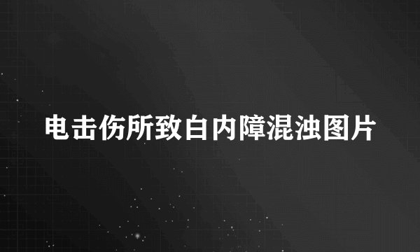 电击伤所致白内障混浊图片