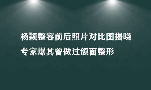 杨颖整容前后照片对比图揭晓专家爆其曾做过颌面整形