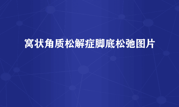 窝状角质松解症脚底松弛图片