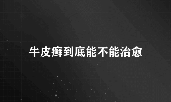 牛皮癣到底能不能治愈